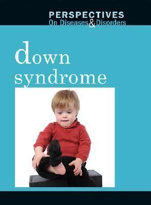 Full Download Down Syndrome By Dawn A Laney