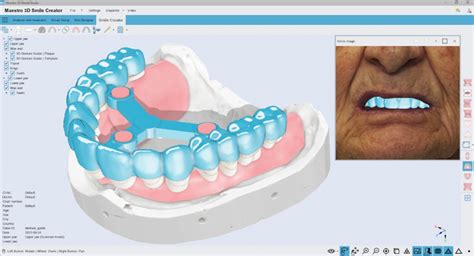 Download Dental Studio - Maestro 3D