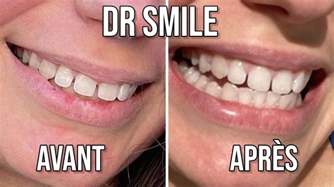 Dr smile beschwerde