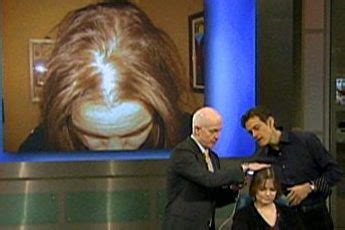 Dr. Oz Show: Hair Loss in Women