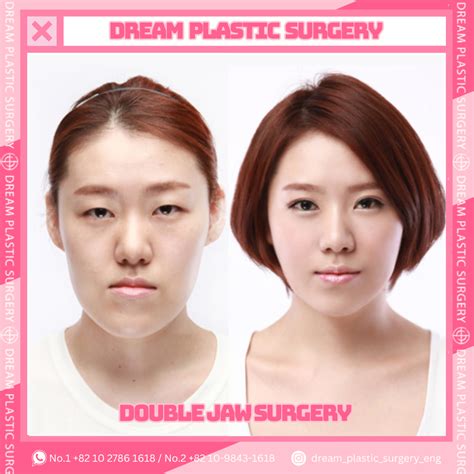 Dream Plastic Surgery