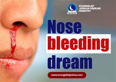 Dream of someone nose bleeding. .  <a href=https://buh.sobi.com.ru/0bt2hvm/spe...