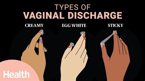 Key takeaways . Brown discharge is caused by oxidized blood when it’s mixed with normal discharge.; While a change in discharge can be alarming, brown discharge is usually normal and nothing to worry about. It could be a sign that your period has just ended or is about to start or that you’re ovulating.; Sometimes, brown …