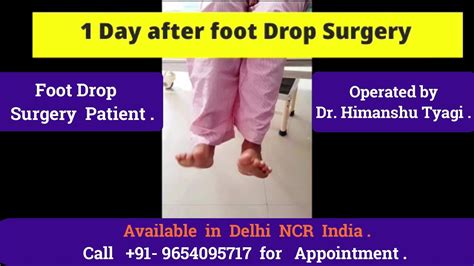 Drop Foot Surgery near Braintree, MA - WebMD