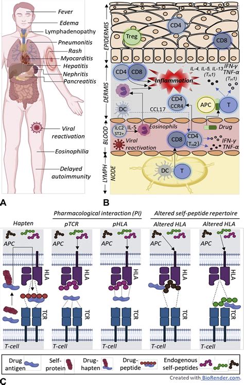 Drug-induced hypersensitivity syndrome (DiHS)/drug