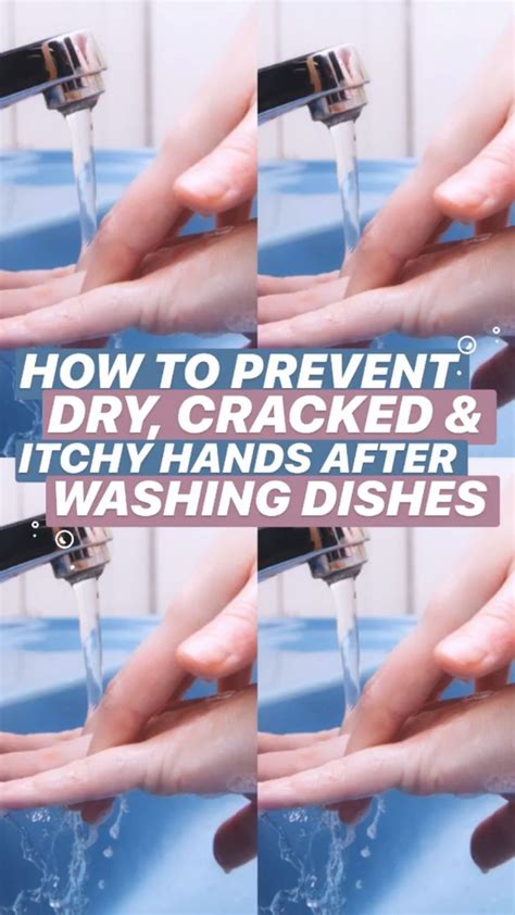 Dry and itchy hands while washing dishes? These simple tips