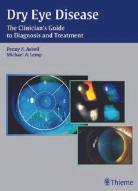 Dry eye disease the clinicianaposs guide to diagnosis. - Been there done that try this an aspie s guide.