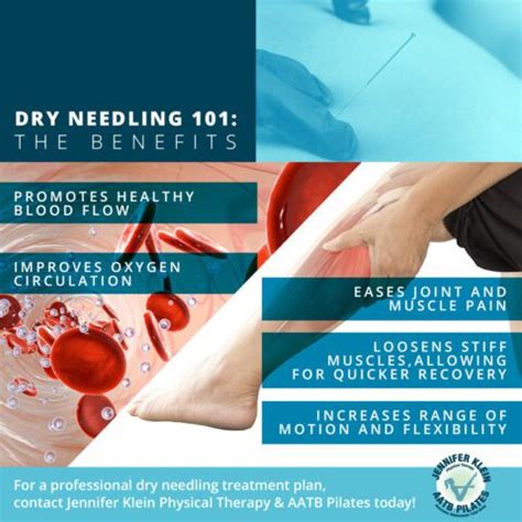 Dry needling in addition to standard physical therapy treatment …