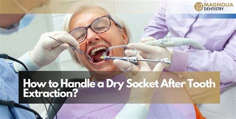 Dry socket after tooth extraction treatment.  Having a tooth removed is called an e...
