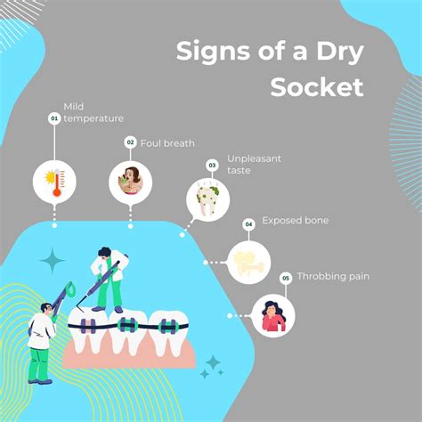 Dry socket treatment at home.  This article provides step-by-step instructions on how to...