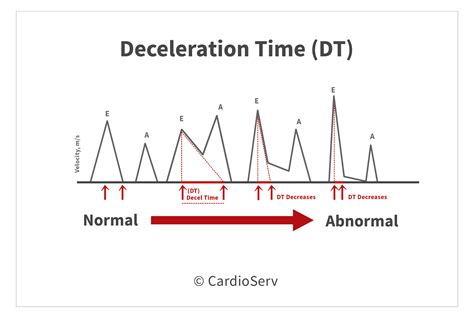 Duration measurement. It is very important to analyze each QRS complex on the tracing and report the duration measurement and describe the shape (including any changes in shape). As discussed in step 3, when referring to P waves, remember changes in the shape of the waveform can indicate the locus of stimulation has changed or a different conduction pathway was ... 