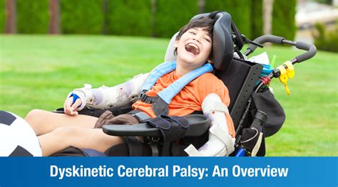 Dyskinetic Cerebral Palsy - Cerebral Palsy Alliance