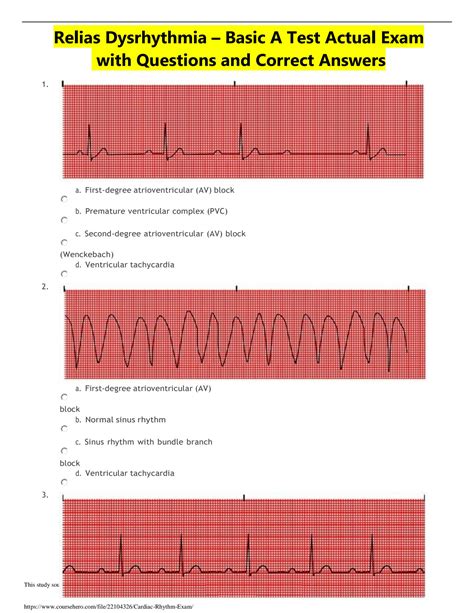 Dysrhythmia Basic B Test Relias Dysrhythmia Basic B Test Questions and