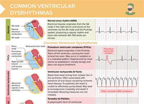 Dysrhythmia Cheat Sheet