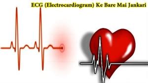 ECG (Electrocardiogram) Kyu Aur Kese Kiya Jata …