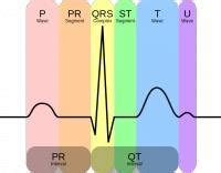 ECG (elektrocardiografie) beoordeling in zeven stappen