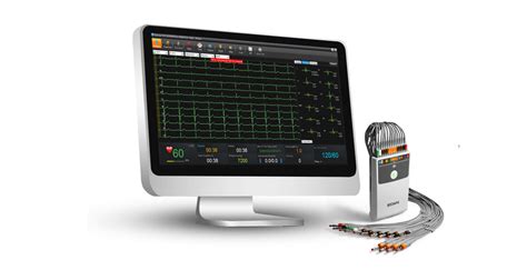 ECG - CardioScan Australia