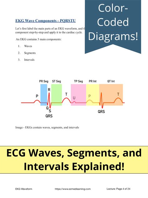 ECG Waveform Explained EKG Labeled Diagrams And Components