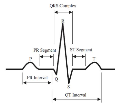 ECG Waveform Explained EKG Labeled Diagrams And Components, 60 OFF