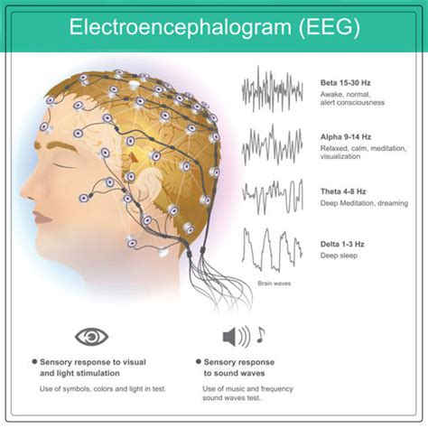 EEG Test - Purpose, Results, Normal Range, and more - coolestguyplanet.net