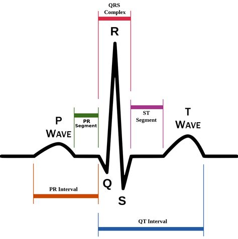 EKG Diagram Labeled