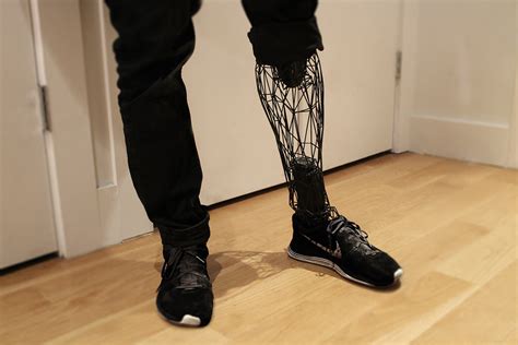 EXO 3D Printed Prosthetic Limbs by William Root Homeli