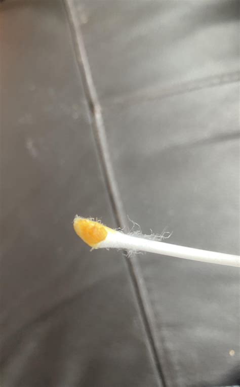 Ear wax!! : r/mixedrace - Reddit