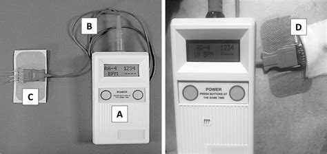 Early use of an implantable diaphragm pacing …