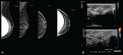 Earnutcha Onlyfans Leak 😈 +18