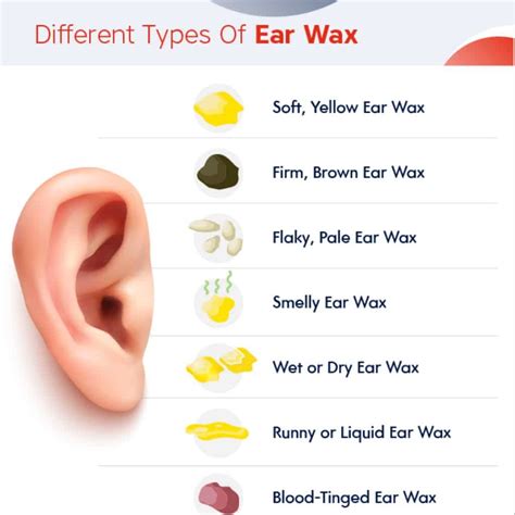 Earwax: Why It