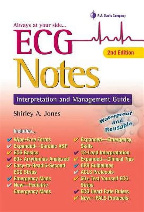 Ecg notes interpretation and management guide daviss notes 2nd second edition. - The kite and windsurfing guide europe the first comprehensive spotguide.