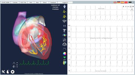 Ecg simulator app.  ECGSIM is an interactive simulation program, aimed at resea...