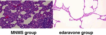 Edaravone injected at the start of reperfusion suppresses ...