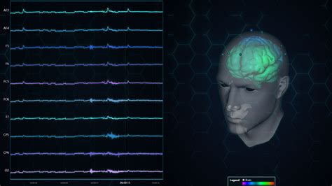 Eeg data analysis.  More recently, it has Here, we present a thorough analysis of cutting-edge A...