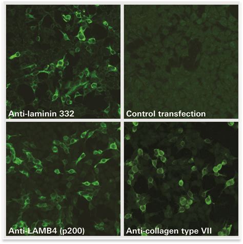 Ef core version.  Enhanced Detection of Dermal-Binding Autoantibodies in Pemphigoid Di...