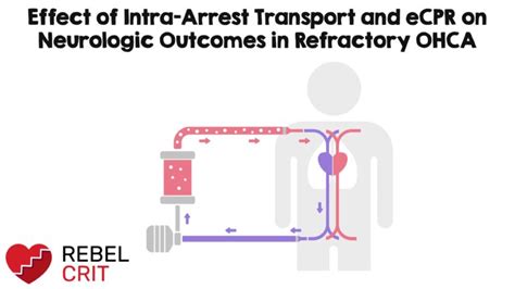 Effect of IntraArrest Transport and eCPR on Neurologic in