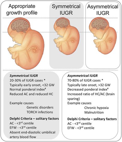 Effects of intrauterine growth retardation on mental …