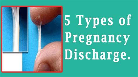 Egg white discharge instead of period. Things To Know About Egg white discharge instead of period. 