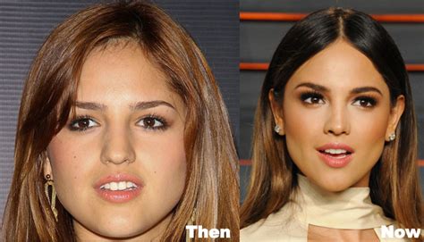 ^ Eiza Gonzalez in 2010 after her one admitted plastic surgery. 
