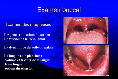 Ejac buccales. Things To Know About Ejac buccales. 