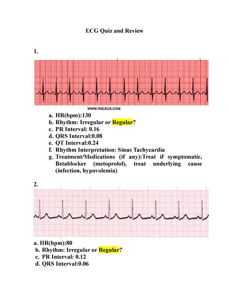 Ekg practice test with answers quizlet. a. A QRS complex >0.12 second followed by a P wave. b. Continuous wide QRS complexes with a ventricular rate of 160 bpm. c. P waves hidden in QRS complexes with a regular rhythm of 120 bpm. d. Saw-toothed P waves with no measurable PR interval and an irregular rhythm. Click the card to flip 👆. Answer: a. 