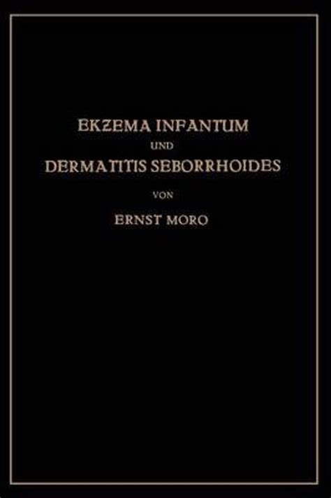 Ekzema infantum und dermatitis seborrhoides, klinik und pathogenese. - User centered design a developer s guide to building user.