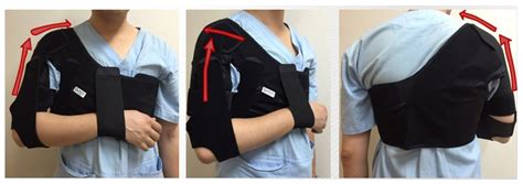 Elastic Dynamic Sling on Subluxation of Hemiplegic