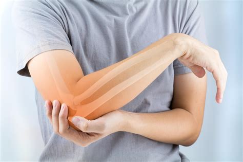 Elbow pain: MedlinePlus Medical Encyclopedia