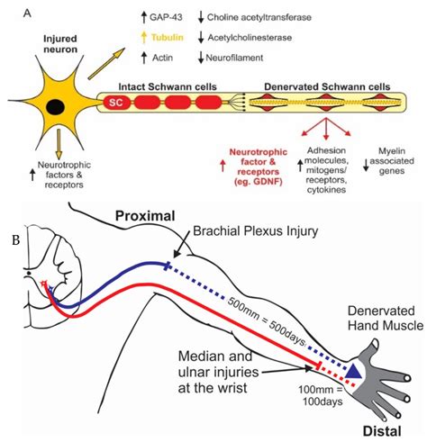 Electrical stimulation for peripheral nerve injury. .  ...