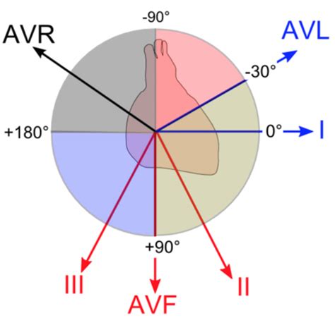 Electrocardiograms (EKGs/ECGs): Determining Axis …