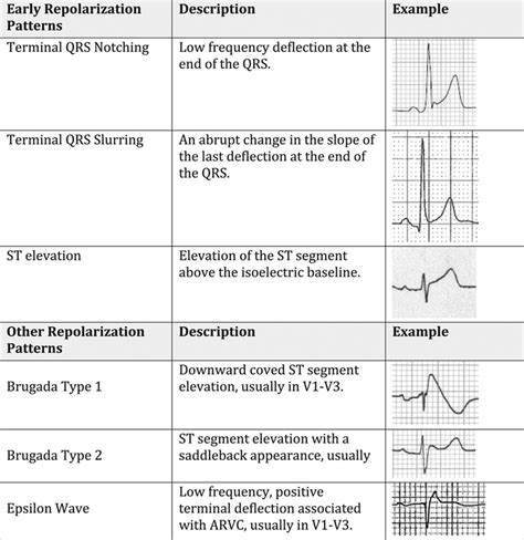 Electrocardiographic Early Repolarization Circulation
