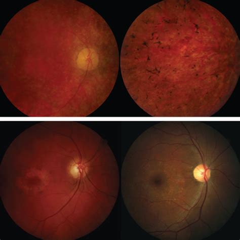 Electrodiagnostics in Today’s Practice - Review of Optometry