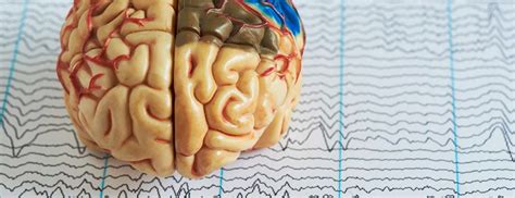 Electroencephalogram (EEG) Johns Hopkins Medicine Health Library