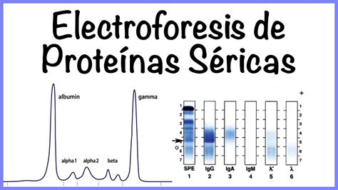 Electroforesis de proteínas séricas Cigna